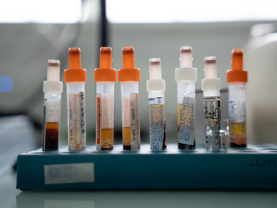 Gefüllte länglich Probenbehälter aus Plastik. Darin Flüssigkeiten in gelb und orange. Auf den Röhrchen kleben beschriftete Etikette.