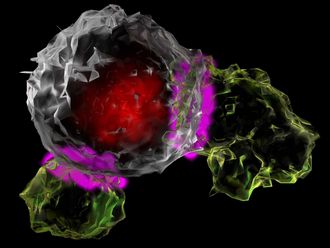 Zwei CAR-T-Zellen greifen ine Tumorzelle an