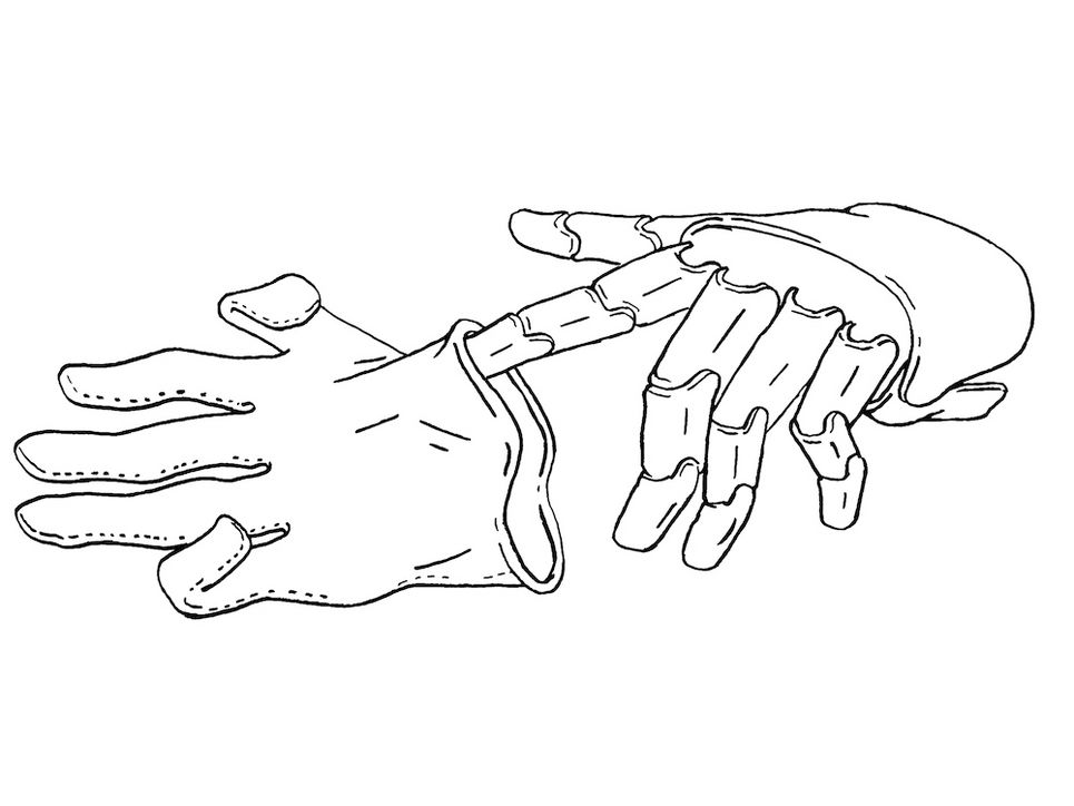 Illustration einer Handprotese, deren Zeigefinder halb in einem Handschuh steckt.