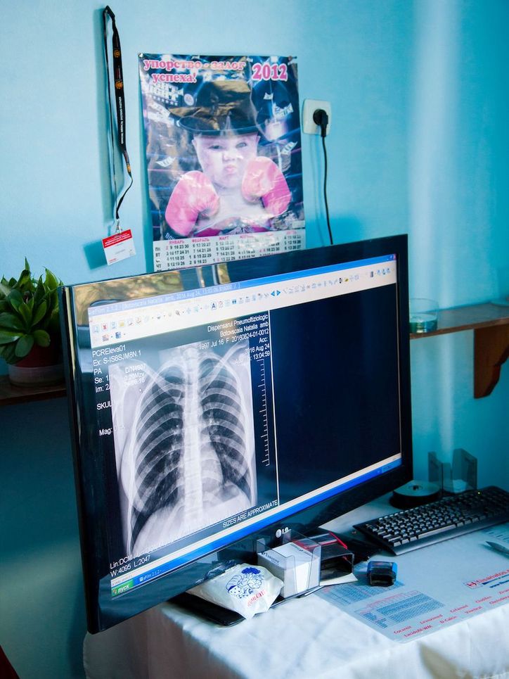 Röntgenaufnahme des menschlichen Brustkorbs auf einem Bildschirm.